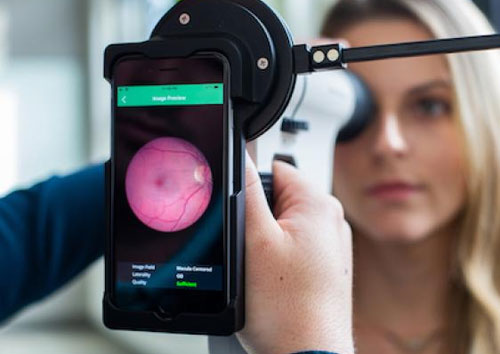 Diabetic Retina Screening