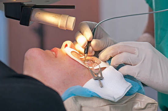 Best Cornea and Refractive Surgeon in Chembur