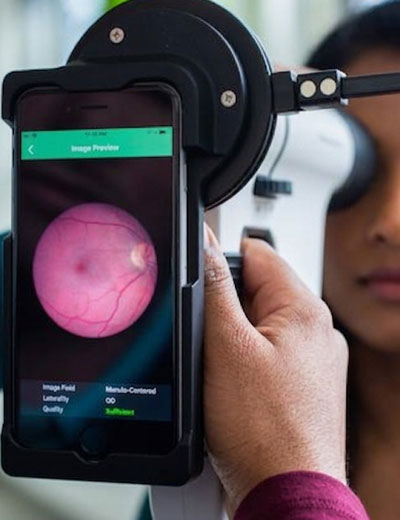 Diabetic Retina Screening